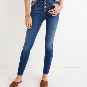 Madewell 10” Fly Button Skinny Jeans